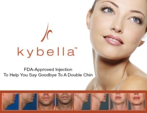 kybella injections in boise 300x232 1