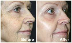 facial treatments clip image002