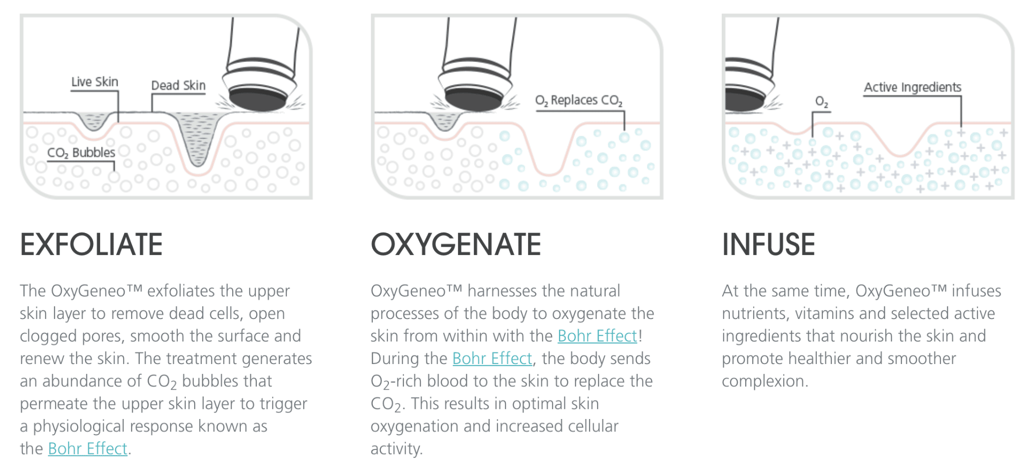 cross section drawing of oxygeneo facial treatment removing dead skin